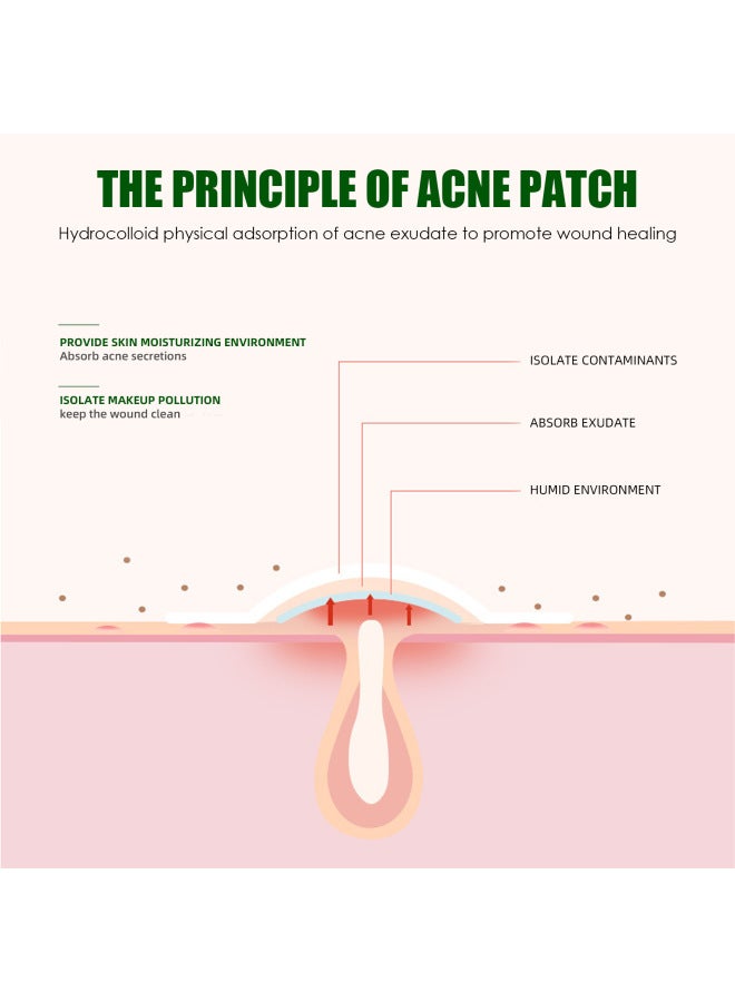 WEST MONTH u0026 Month Liquid Absorbent Pox Patch Invisible Makeup Artificial Skin Care Essential Oil Waterproof Concealer Breathable Pox Patch - Image 4