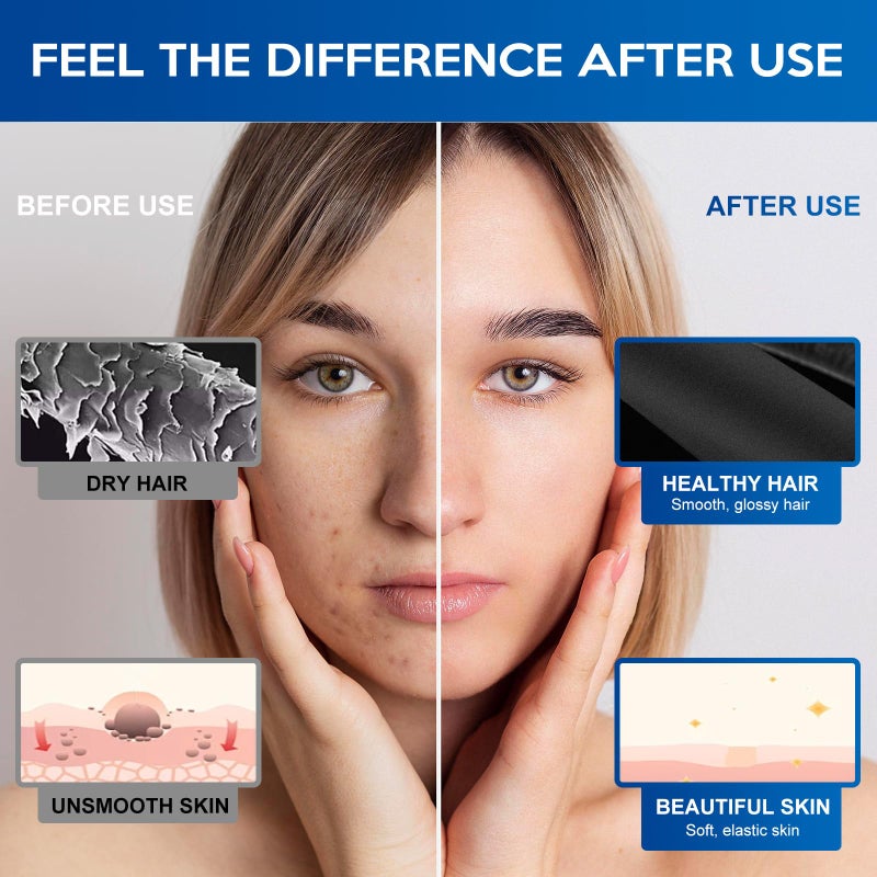 Luxsego Shower Head Filters for Skin Care Shower Head, 4 PCS PP-Cotton Filter Cartridge with Replacement Mineral Filter Beads(1oz), Ideal for Hydro Jet Filtered Showerhead Purify Hard Water - Image 5