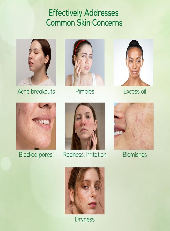 Pil Neem Plus Face Wash Gel | Face Wash Gel for Acne, Pimpled & Oily Skin | Clear & Smooth Radiant Skin | 50 gms each (Pack of 3) - Image 4