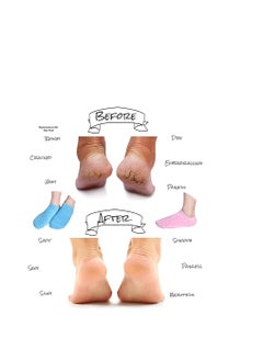 Relax Smart 4 Pieces Silicone Gel Moisturizing Socks To Repair And Soften Dry Cracked Foot  - Image 2