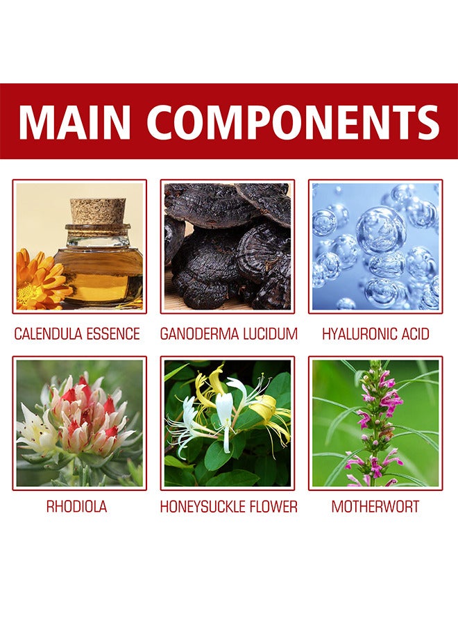 SOUTH MOON Milia Removal Essential, Milia Spot Treatment Helps Dissolve And Reduce Milia, Whitehead And Sebaceous Hyperplasia 30 ML - Image 2