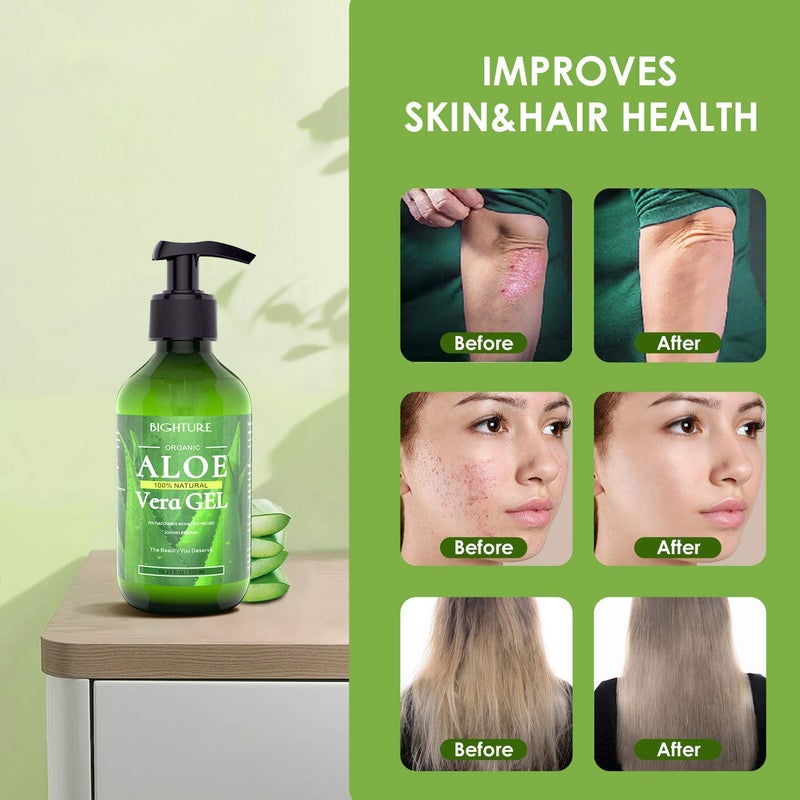 BIGHTURE Aloe Vera Gel, 100% Aloe Vera from Freshly Cut Aloe Leaves, Skin Care for Deeply & Rapidly Soothing, Firming, After Shave, Sunburn Relieve, etc - Image 5