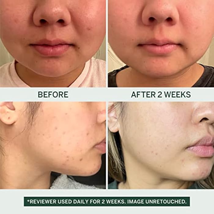 FACETORY Urban Calm Hydrating Face Wash for Women, Gentle Gel Facial Cleanser with Fermented Pear & LHA, Sensitive Skin Face Wash & Daily Makeup Remover for Oily, Dry & Combination Skin - 1 Fl Oz - Image 5