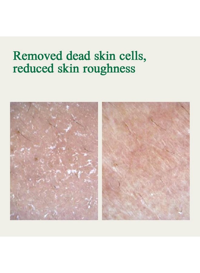 أمبولة بيونكانغ يول للحل الأمثل للتهدئة مع زبدة الشيا وزهرة زهر العسل والسيراميد وسيكا لتهدئة وترطيب البشرة الجافة والحساسة بسرعة، للعناية بجمال الوجه الكوري، 1.01 أونصة سائلة. - Image 5