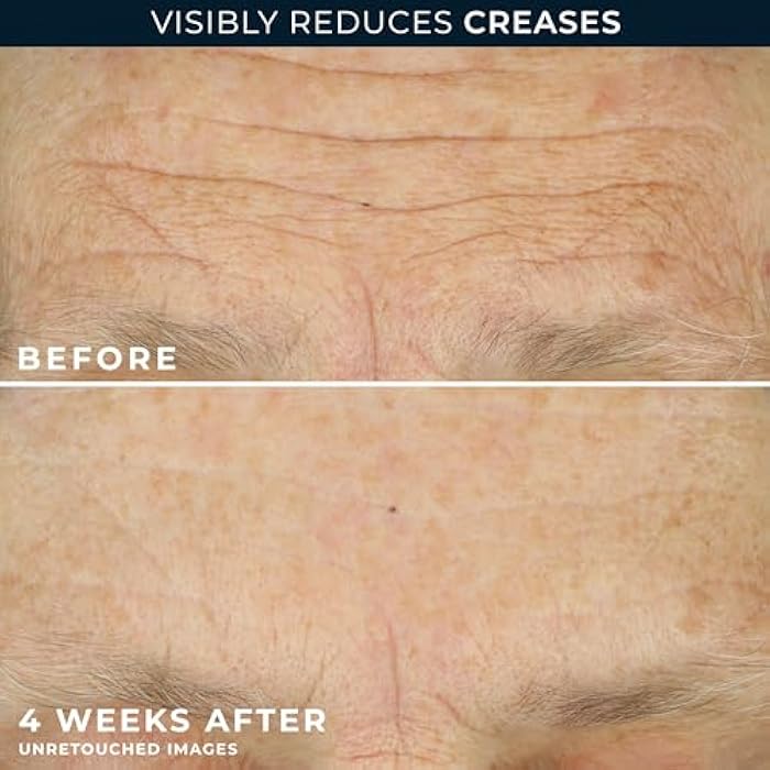 RoC Crepe Repair Anti Aging Daily Face Moisturizer & Neck Firming Cream (1.7 oz) + RoC Retinol Wrinkle Smoothing Capsules (7 CT), Skin Care Routine for Women and Men - Image 5