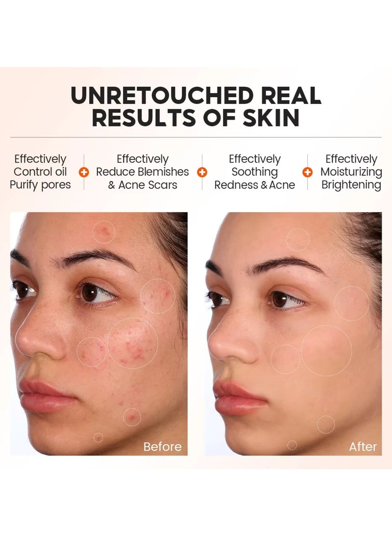 Vibrant Glamour Salicylic Acid Exfoliating Serum for Face Reduce Redness and Blemishes Soothing and Calming Moisturizing and Hydrating Revitalizing and Nourishing Skin Exfoliant Serum 30ml  - Image 2