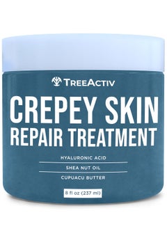 TreeActiv TreeActiv Crepey Skin Repair Treatment Original Formula 8 fl oz Firming Cream For Face  Neck Skin Firming Lotion with Hyaluronic Acid Crepey Skin Treatment to Address Dry Crepe Skin 