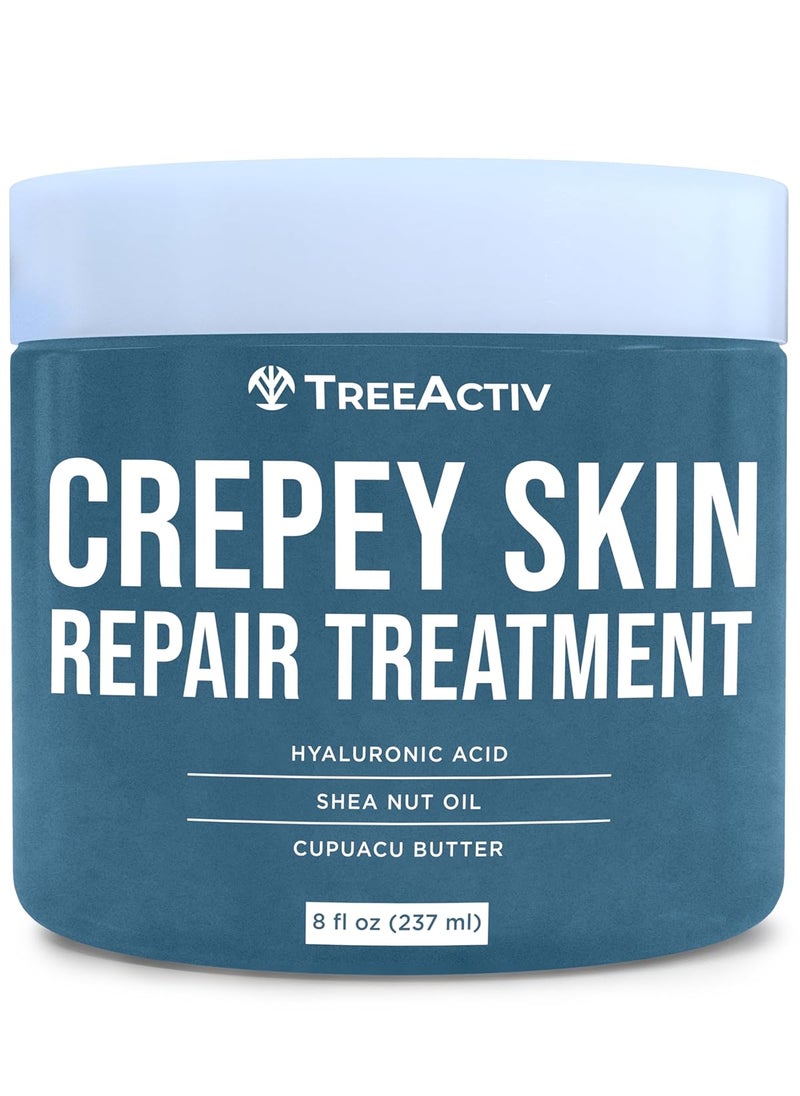 TreeActiv TreeActiv Crepey Skin Repair Treatment Original Formula 8 fl oz Firming Cream For Face  Neck Skin Firming Lotion with Hyaluronic Acid Crepey Skin Treatment to Address Dry Crepe Skin 