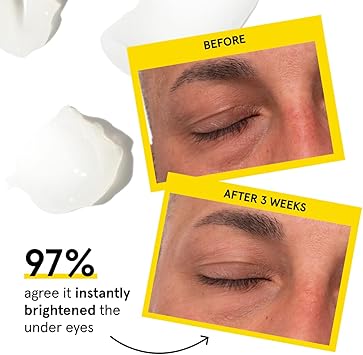 LUMIN Lumin Mens Dark Circle Defense Balm AntiAging Korean Formulated Eye Cream Treatment for dark circles fine lines wrinkles Suitable for all skin types Daily Use 20ml 1Pack - Image 2