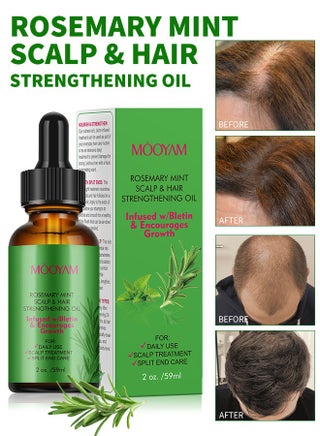 Rosemary Mint Scalp & Hair Strenghtening Oil 59ml Pure Rosemary Oil for Hair Growth & Skin Care Nourishment Scalp Stimulates Hair Growth Rid of Itchy and Dry Scalp Refreshing Aromatherapy Oil for Men Women - pzsku/Z2666A95913F1B625A172Z/45/1751004120/9cfcfbbf-00df-4b41-94f9-3da9a139ba85