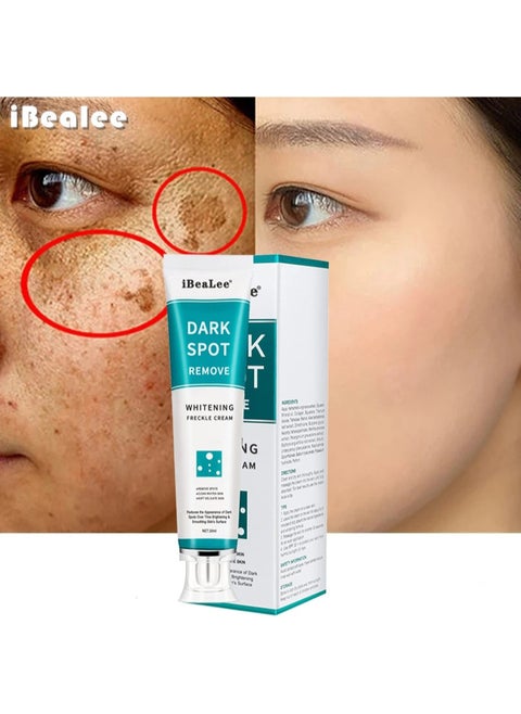 Dark Spot Remover for Face Peeling Skin Whitening Freckle Cream Pigmentation Treatment Sun Spots Age Spots Blemish Remover Lightening Cream