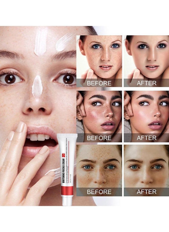 EELHOE - Whitening Freckle Cream, Help Reduce Dark Spots, Anti-Aging, Beauty Skin Care, Spot Cream, Spot Treatment 20G - Image 1