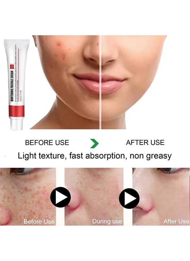 EELHOE - Whitening Freckle Cream, Help Reduce Dark Spots, Anti-Aging, Beauty Skin Care, Spot Cream, Spot Treatment 20G - Image 1