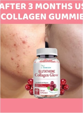 NATURE GLOW Nature Glow Glutathione Collagen Glow Skin Whitening & Brightening Gummies | Anti-Aging, Acne & Dark Spot Remover 60 Gummies | Best Price KSA | Riyadh, Jeddah NATURE GLOW Nature Glow Glutathione Collagen Glow Skin Whitening & Brightening Gummies | Anti-Aging, Acne & Dark Spot Remover 60 Gummies | Best Price KSA | Riyadh, Jeddah