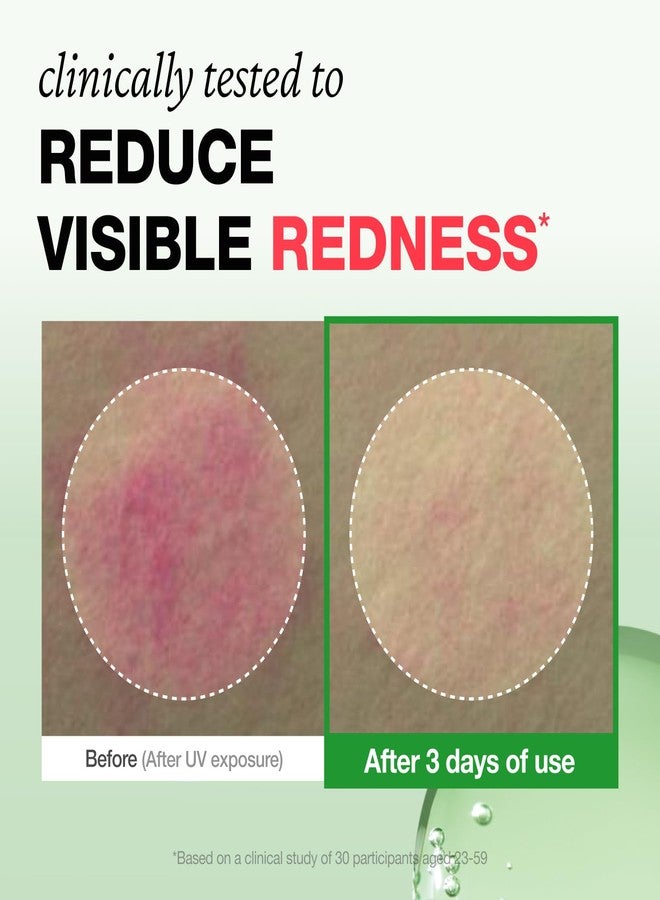 PHYSIOGEL Rosateca Redness Reducing Serum with Troxerutin, Reduces Visible Redness & Support Skin Barrier, Suitable for Oily & Sensitive Skin, 30ml - Image 3