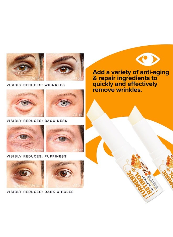 SAUVASINE - Turmeric Retinol Eye Cream Stick,Lumibalm for Under Eye Bags, Eye Balm Stick Hydrating,Lumistick for Puffiness and Bags Reduces,Anti Aging Eye Balm Stick Hydrating 5g - Image 1
