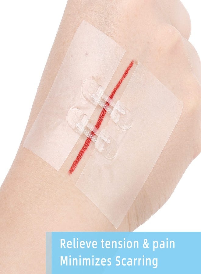 LotFancy لوتفانسي إغلاق الجروح الطارئة، 4 قطع، مستلزمات الإسعافات الأولية، لاصقات طبية على شكل فراشة، مجموعة إصلاح الجروح الجراحية مع الملحقات، معقمة، خالية من اللاتكس - Image 3