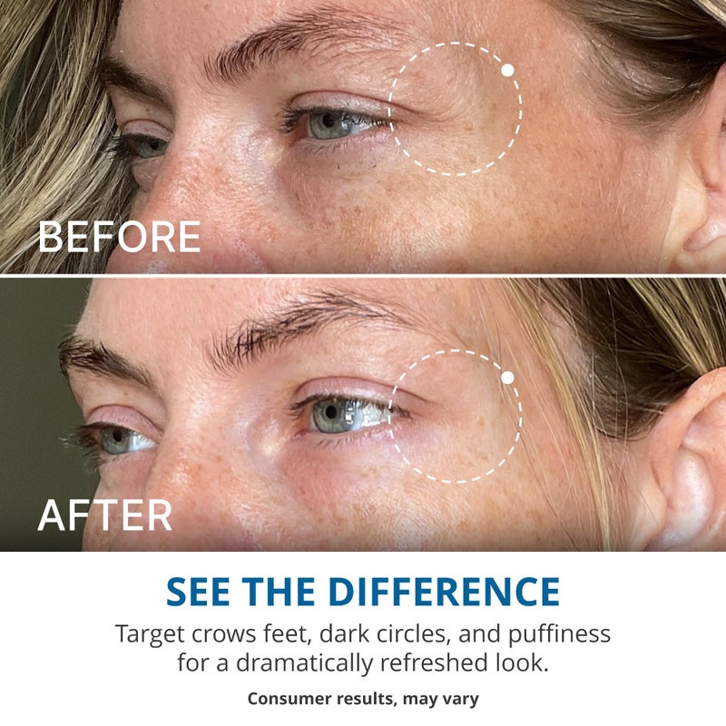 goPure Advanced Repair Eye Cream - Under Eye Cream for Puffiness, Bags, and Dark Circles, Visibly Improve the Look of Fine Lines, Wrinkles, and Crows Feet - 0.57 fl oz - Image 4