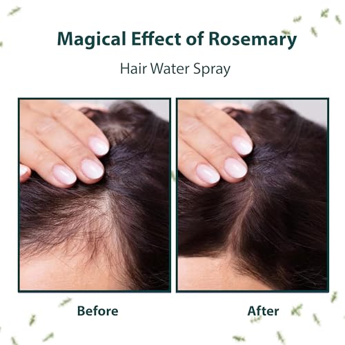Moolveda Rosemary Water Spray For Hair Care | Rosemary Hair Mist | Adds Shine | Helps Reduce Hairfall | Strengthens Hair | Suitable For All Hair Types, 200ml - Image 5