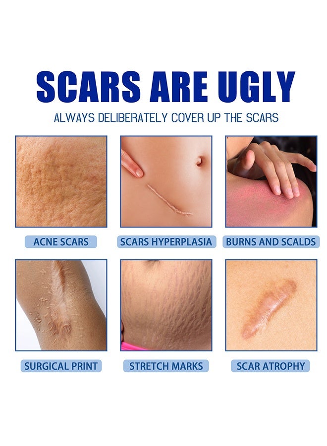 Jaysuing Scar Removal Cream - Acne Scar Cream Rapid Repair Scar Cream for Acne Surgery Injury Burns Advanced Gel Acne Scar Spot Treatment Suitable for All Skin Types 30g - Image 5