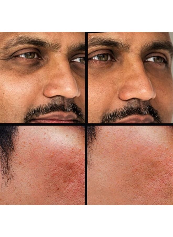 KODE Mens - كونسيلر (درجة 2 من 6) كريم تصحيح الهالات السوداء تحت العين، متعدد الاستخدامات، البثور، الندبات، الطفح الجلدي - Image 1