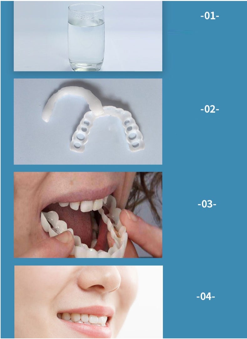 SNAP - Teeth Veneers Anti-true Braces Snap On Smile Teeth Whitening Denture Teeth Comfortable Veneer Cover Teeth - Image 1