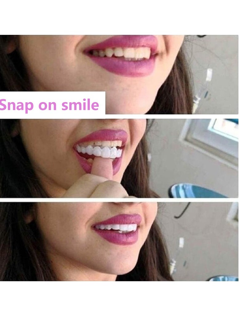 SNAP - Teeth Veneers Anti-true Braces Snap On Smile Teeth Whitening Denture Teeth Comfortable Veneer Cover Teeth - Image 1