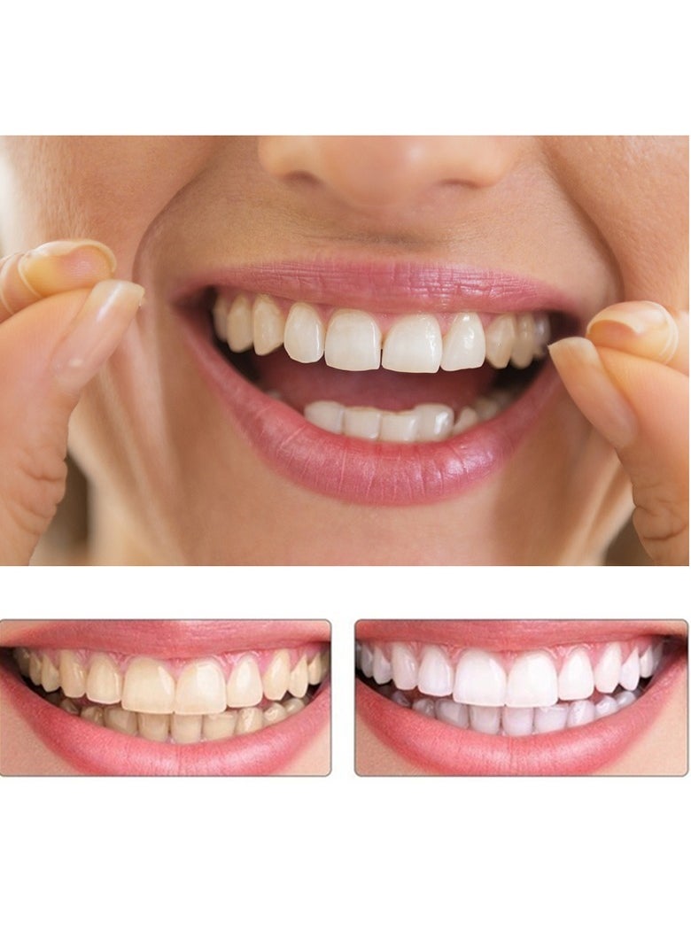 SNAP - Teeth Veneers Anti-true Braces Snap On Smile Teeth Whitening Denture Teeth Comfortable Veneer Cover Teeth - Image 1