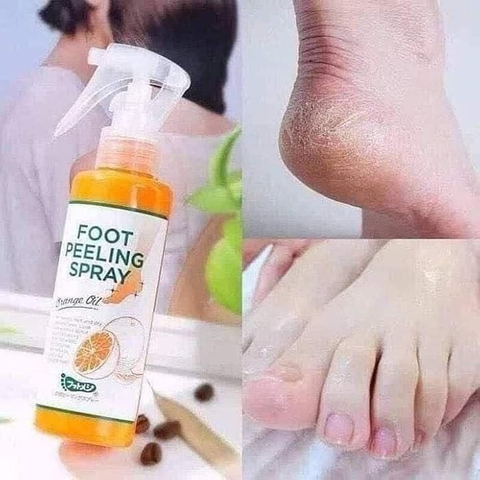Instant Foot Peeling Spray Exfoliate Dead Skin & Black Skin in Elbow & Knee Quickly and Effectively Exfoliates Dead Skin and Knees Made of Natural Materials Safe to - Generic - Image 1