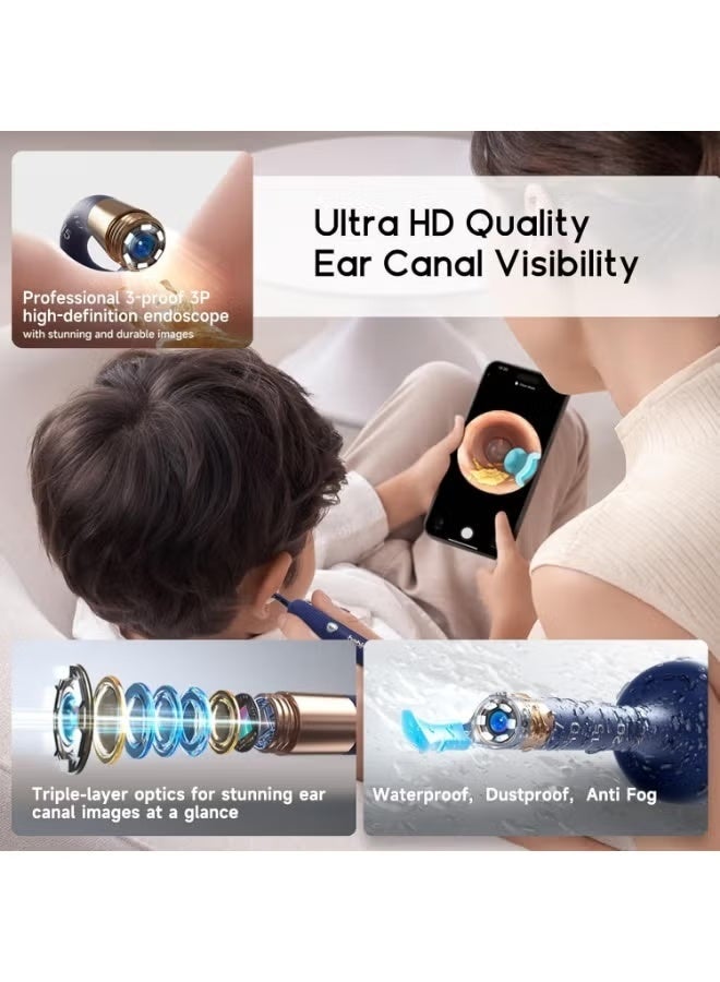 Bebird Ear Wax Removal Tool Camera, Visual Earwax Cleaner with Cleaning Kit as Spade Tweezer Spoon Pick Clean Ears for Family, Otoscope Ear-Scope Wireless WiFi Connect - Image 3