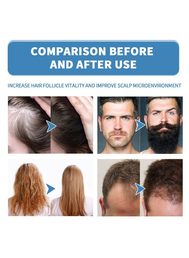 إيست مون مينوكسي لعلاج الشعر ، نمو شعر صحي ، مضاد لتساقط الشعر ، خيوط شعر أكثر سمكا ، علاج اللحية زيت نمو اللحية للرجل 18 مل - Image 4