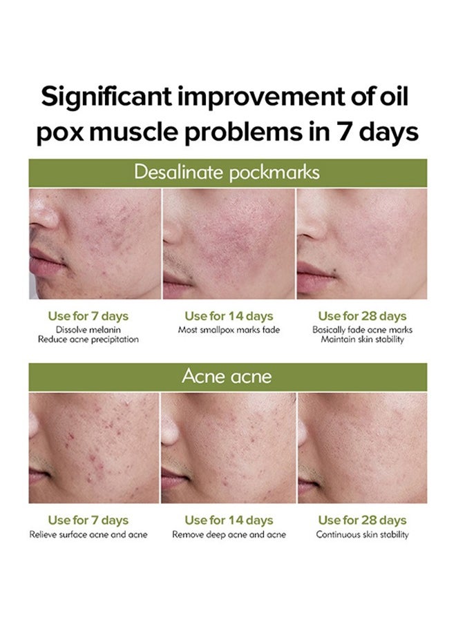 LANEMAY - Natural- Tea Tree Anti Acne Cream,Soothing And Deep Repair, Repair Acne Scar Balance, Natural Cystic Acne Treatment, For All Skin Types 30g - Image 1