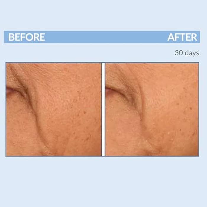 Serious Skincare Vitamin A Force XR Retinol Face Serum Concentrate, Micro Exfoliate & Resurface for Radiant Skin, for Lines, Wrinkles, Pore Minimizer, Anti-Aging 1 Oz. (Pack of 2) - Image 3