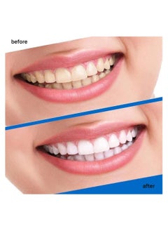 VILILY 84 Pcs 3D White Teeth Whitening Strip Dental Whitening Kit 100% Genuine Branded for Express Fast Result Treatments Professional Whitener Enamel & Stains Removal | Unisex 42 Pairs  - Image 5