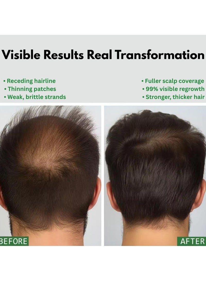 Nouelv Batana Oil for Hair Growth – 100% Pure & Natural Raw Batana Oil from Honduras, Thickens & Strengthens Hair – Deeply Moisturizing Hair Oil for All Hair Types – 4 FL OZ – Unrefined & Cold-Pressed  - Image 4
