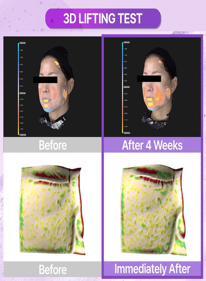 BIOHEAL BOH تونر بيولوجي هيل بوه بروبيوديرم 3D ليفتينغ الأساسي 5.07 أونصة سائلة (150 مل) | تونر مرطب ورافع للوجه مع مركب 17 ببتيد للثبات والمرونة - Image 3