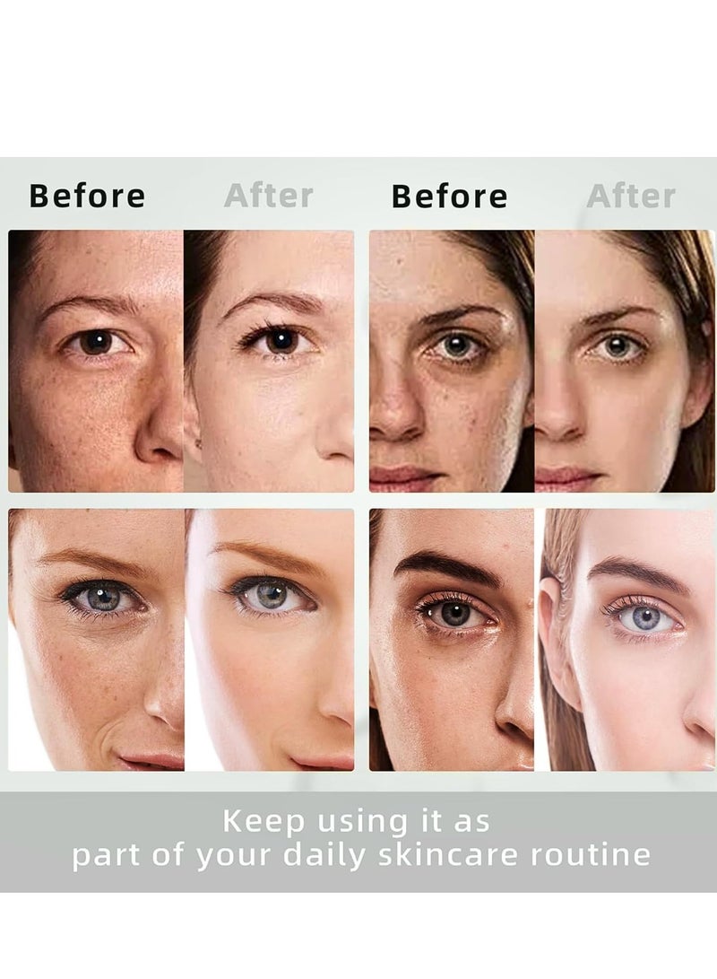 EELHOE Dark Spot Remover For Face, Dark Spot Corrector with Roller, Precise Application, Hydrating Glow, Treatment for Age Spot Sun Spot Freckles Melasma Brown Spot 15G - Image 4