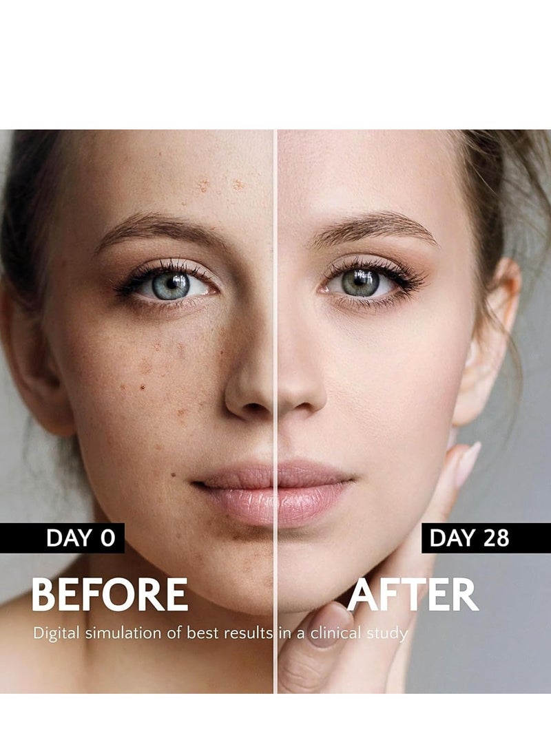 EELHOE Dark Spot Remover For Face, Dark Spot Corrector with Roller, Precise Application, Hydrating Glow, Treatment for Age Spot Sun Spot Freckles Melasma Brown Spot 15G - Image 5