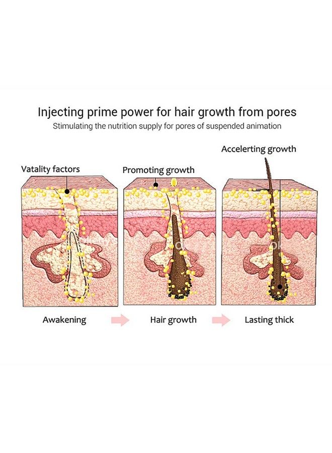 Hair Growth Essence Spray Anti Hair Loss Hair Serum Ginger Hair Growth Serum Spray Natural Hair Growth Accelerator For Stronger Thicker Longer Hair Hair Serum For Hair Growth And Thickening