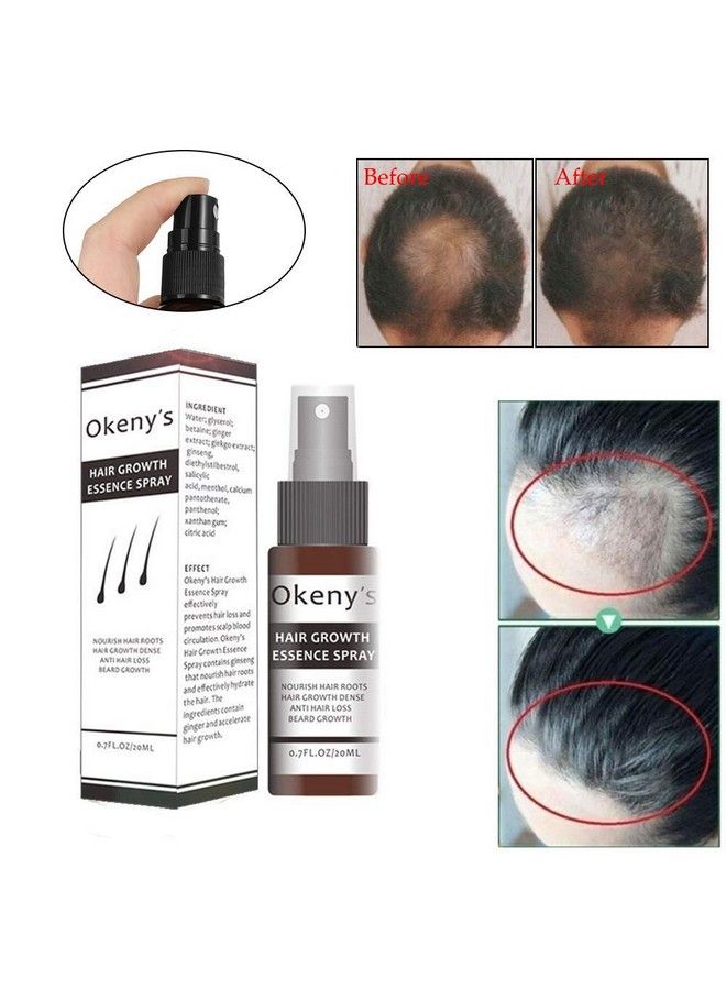 Hair Growth Essence Spray Anti Hair Loss Hair Serum Ginger Hair Growth Serum Spray Natural Hair Growth Accelerator For Stronger Thicker Longer Hair Hair Serum For Hair Growth And Thickening