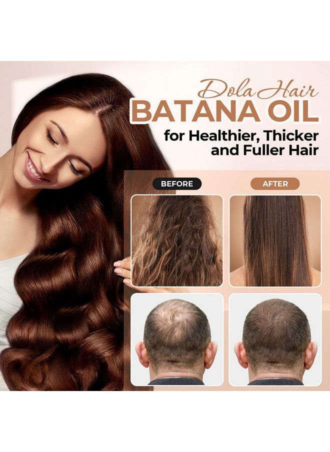 Dolahair Batana Oil for Hair Growth Organics 100% Natural Pure Batana Hair Oil Batana Oil Nourishes Damaged Hair raw Batana Butter Prevent Hair Loss Natural Hair Growth Oil and Conditioner  - Image 5