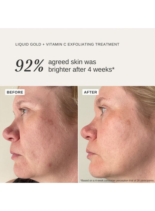 Alpha H Alpha-H Liquid Gold + Vitamin C  100ML - Image 4