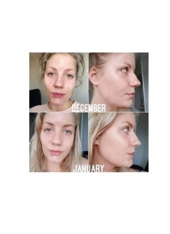 Nourish 2% Alpha Arbutin + Vitamin C Serums( Buy One Get One) - 2*30ml  - Image 5