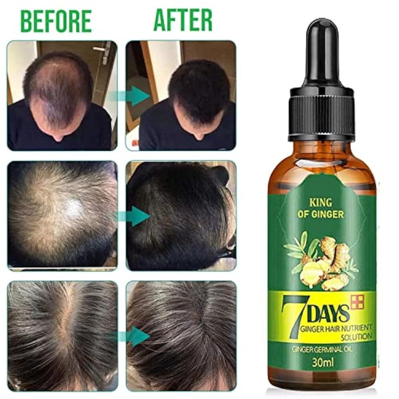 TSSPLUS NEW Arrive Hair Regrow 7 Day,Hair follicle regrowth,Ginger Essential Oil,Ginger Germinal Serum Essence Oil Loss Treatement Growth,grow hair serum,ginger hair growth oil,hair longer(30ML) - Image 4