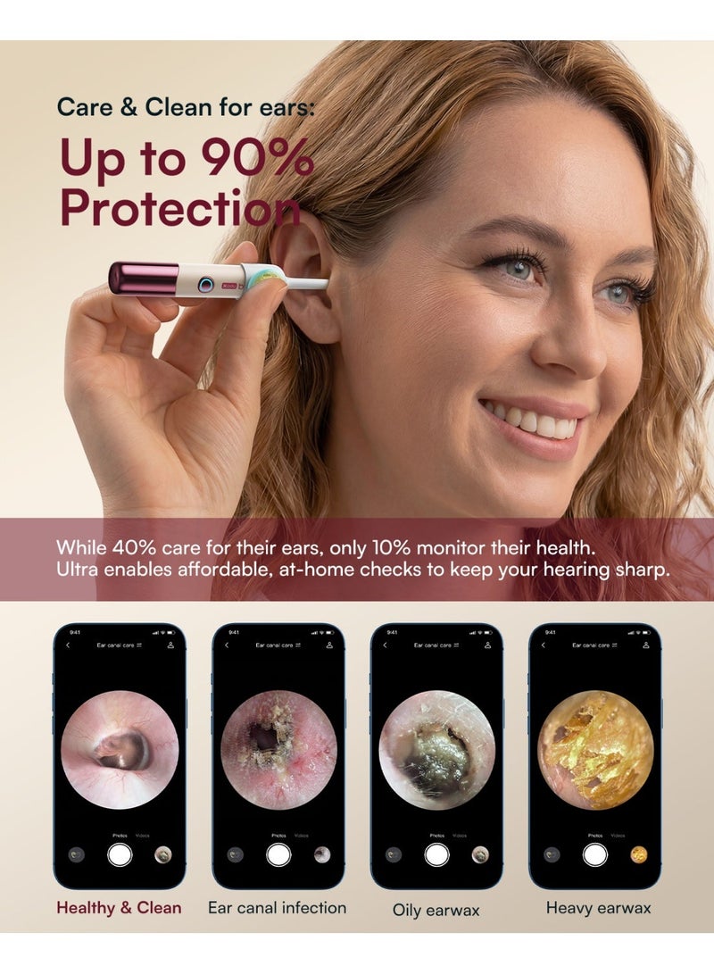 بيبيرد Bebird EarSight Ultra X (إصدار جديد) - Image 2