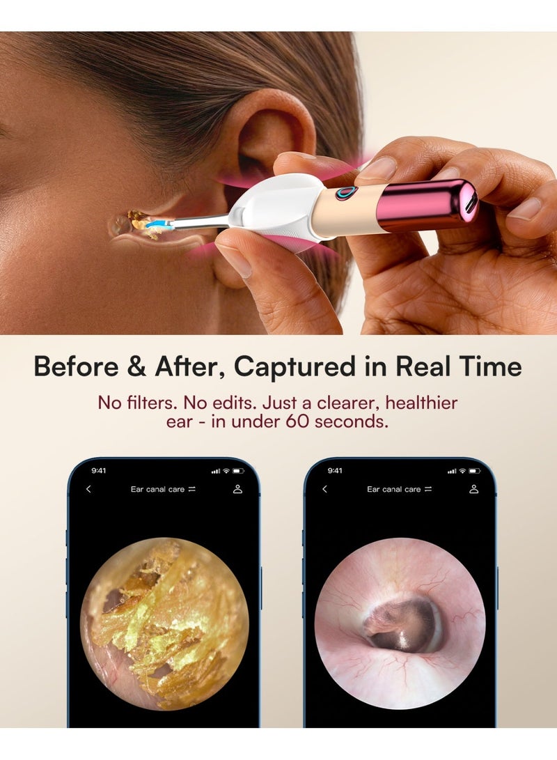 بيبيرد Bebird EarSight Ultra X (إصدار جديد) - Image 5