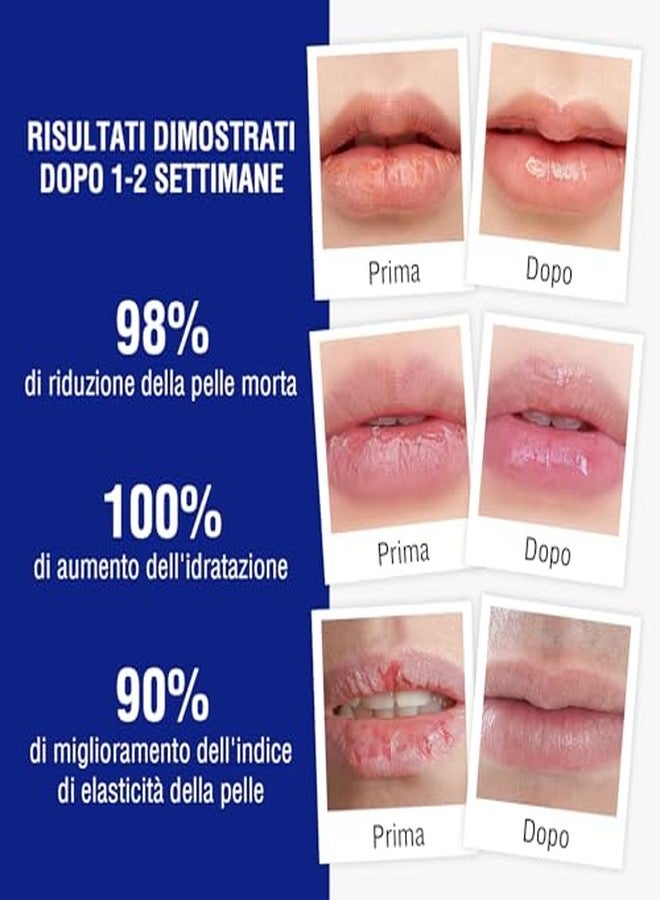 OUKEYA Medicated Lip Balm w/Beeswax, Petrolatum, Peppermint Oi, 100% Natural Ingredients, 24H Long-lasting Hydrating Healing Lip Balms, Lip Moisturizer for Very Dry Lips, Echapped Lips Treatment Severe - Image 2