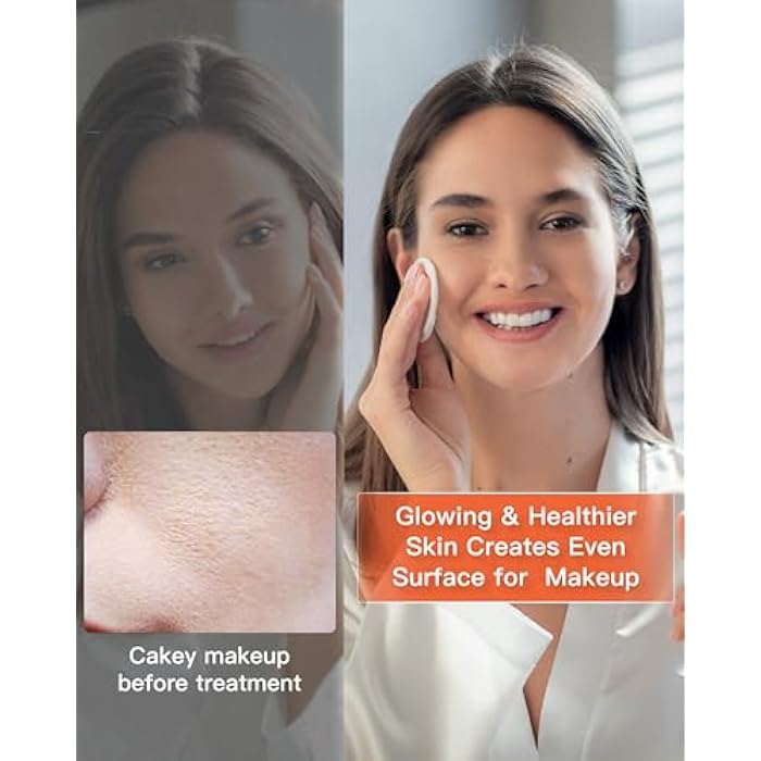 NEWKEY LED Face Mask Light Therapy,Red Light Therapy for Face Wrinkle Blue Light Therapy Mask for Face Acne,150LEDs,10 Min Auto Shut off, Wired - Image 5