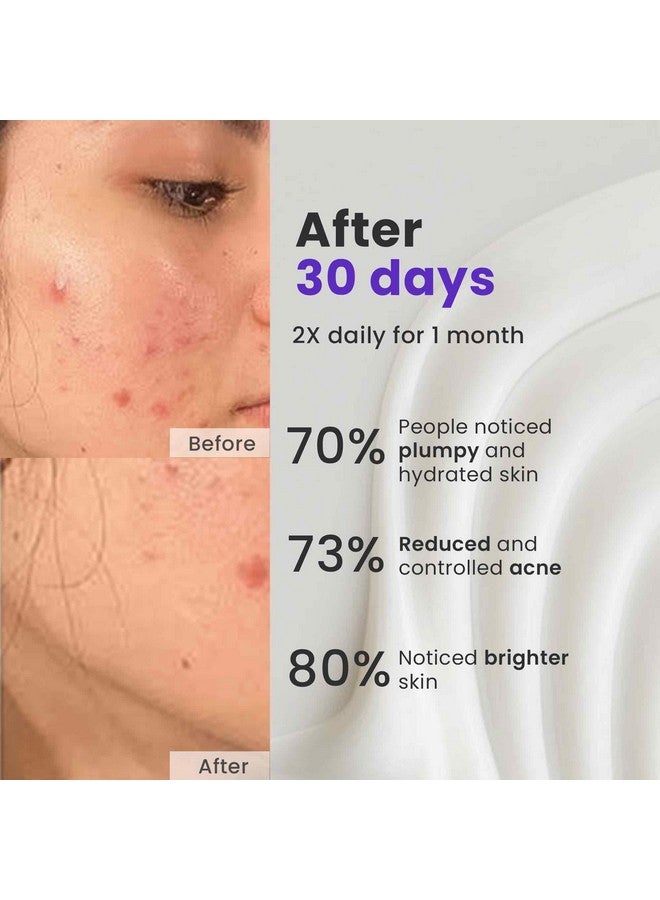 Saffr'n Acne Shield Moisturizer with Acne Buster from Japan, Niacinamide & Saffron | For Acne Breakouts | Fights Acne causing Impurities | Nourishing& Hydrating Moisturizer | For Normal to Oily Acne Prone Skin- 50 ml - Image 4