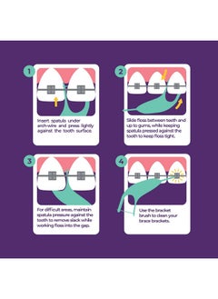 Platypus Platypus Orthodontic Flossers for Braces | Ortho Picks for Adults & Kids | Fits Under Arch Wire | Non-Damaging | Encourage Flossing Habits | Floss Teeth in Less Than Two Minutes | 40 Count (Pack of 1)  - Image 3